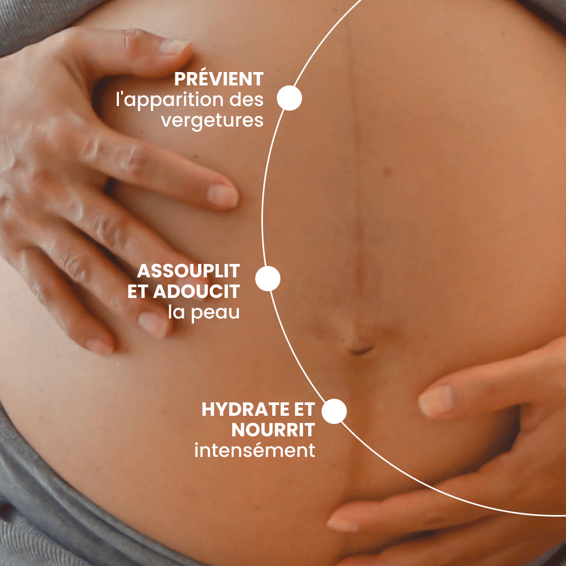 Huile vergetures grossesse 100ml image number 1